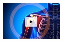 Patient Education Videos